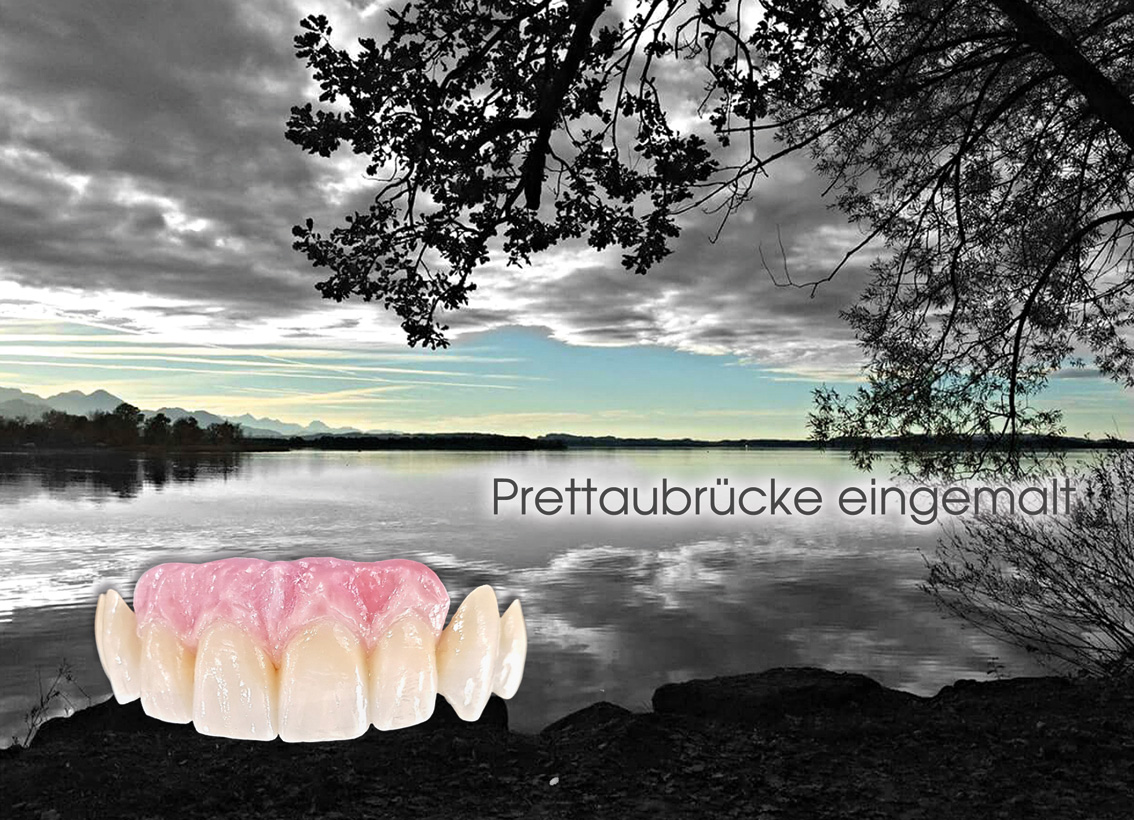 hallweger_dentallabor_10_brettau_01