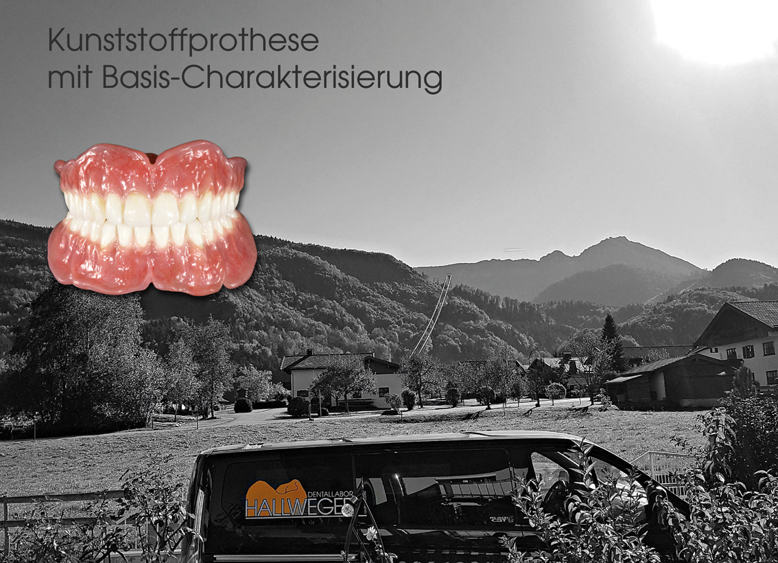 hallweger_dentallabor_12_kunststoffprothese