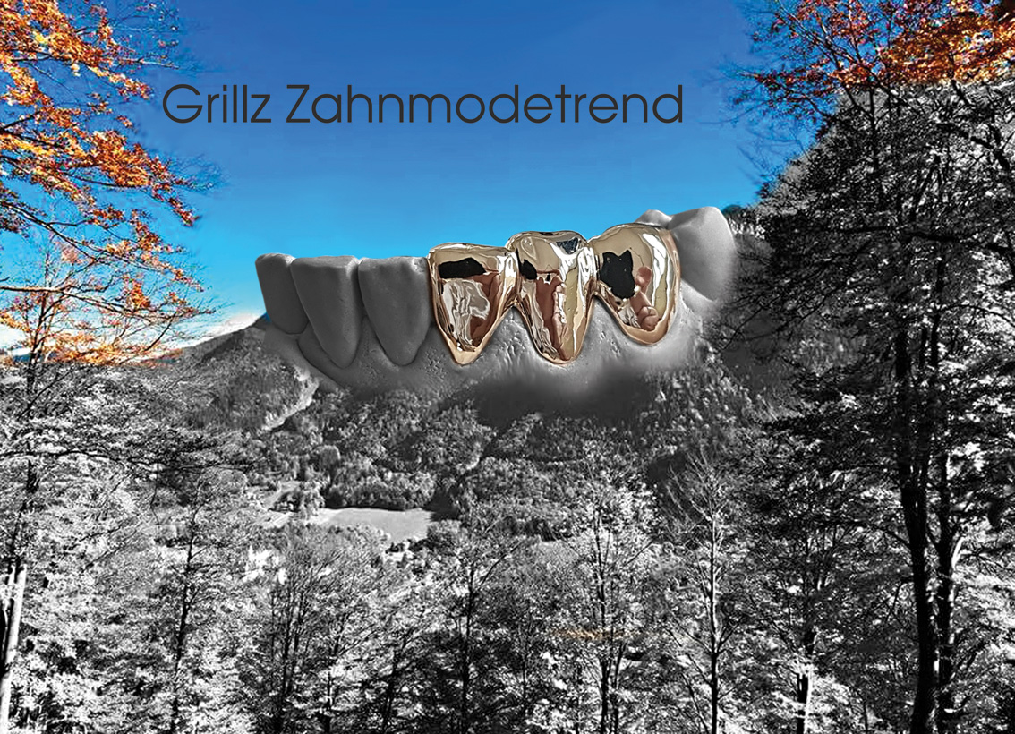 hallweger_dentallabor_14_grillz_02