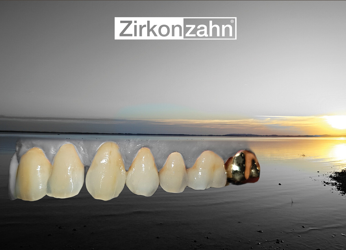 hallweger_dentallabor_5_zirkon