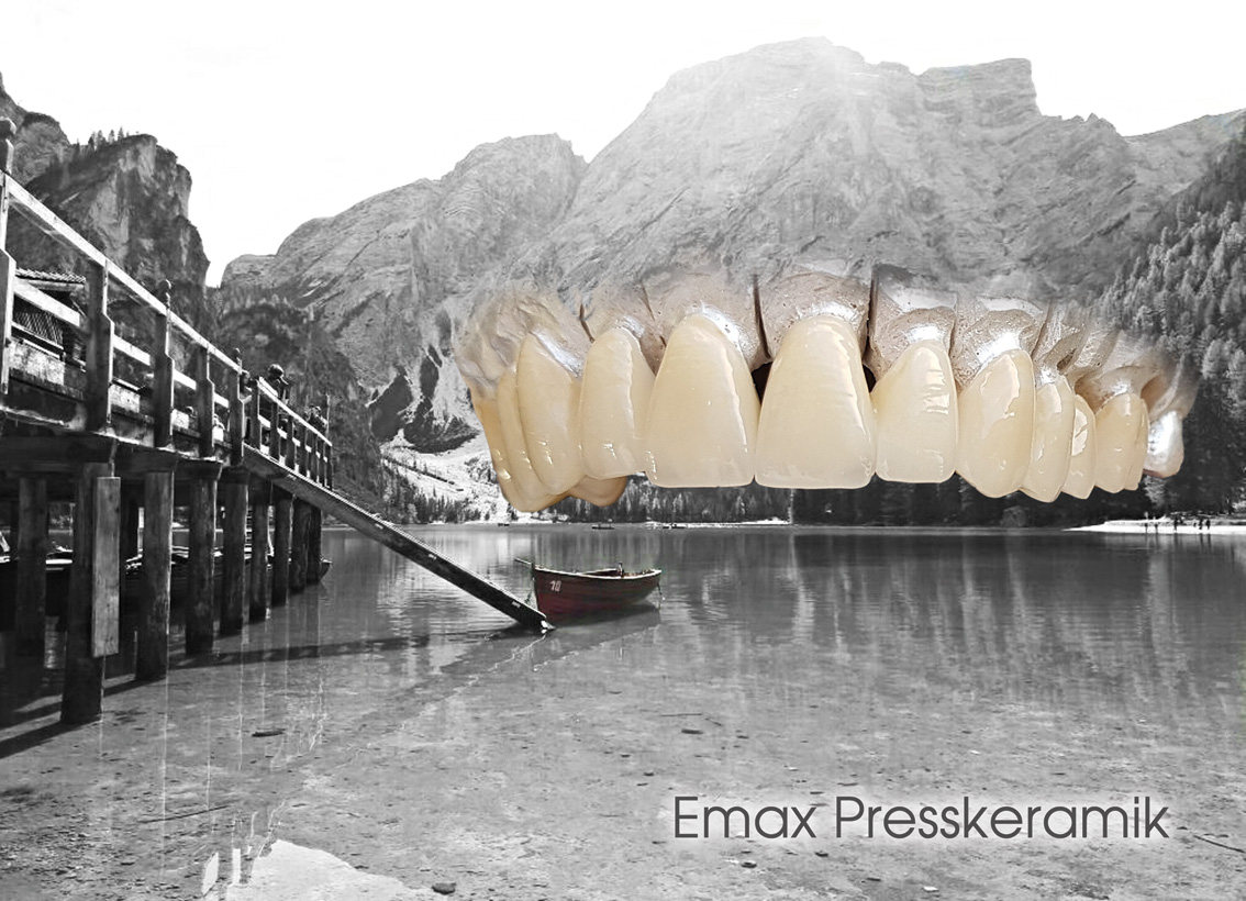 hallweger_dentallabor_8_emax_01