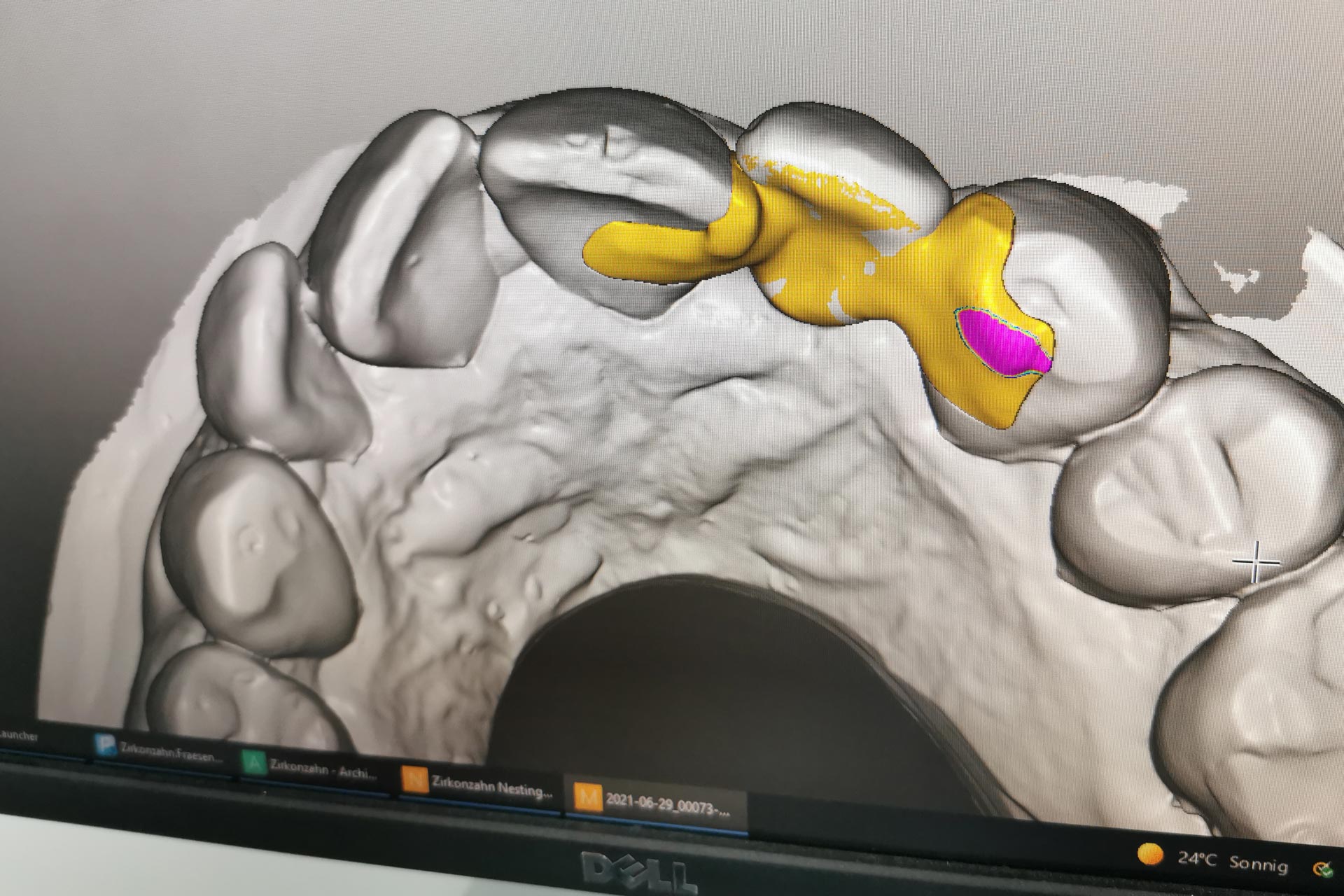 hallweger-dentallabor-showroom-cad-cam_08