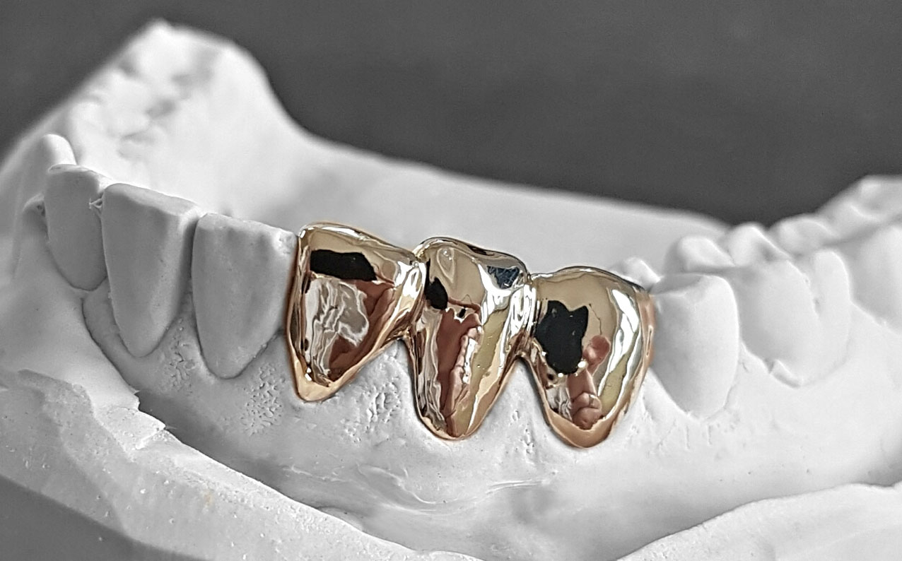 hallweger-dentallabor-showroom-grillz_01