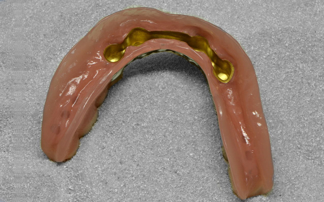 hallweger-dentallabor-showroom-implantatsteg_01